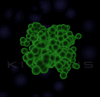 stacks_image_A418D527-D574-477C-968C-3625B137D5BF