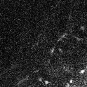Two-photon-triggered Ca²⁺ wave in astrocytes.
