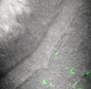 Ca²⁺ wave-induced arteriole constriction visualized by two-photon imaging
